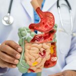 medico mostra plastico di apparato intestinale