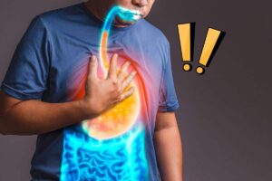 Reflusso gastrico